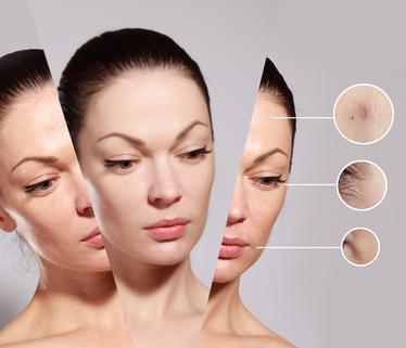 problème-peau-acne-irritées problème-peau-acne-irritées